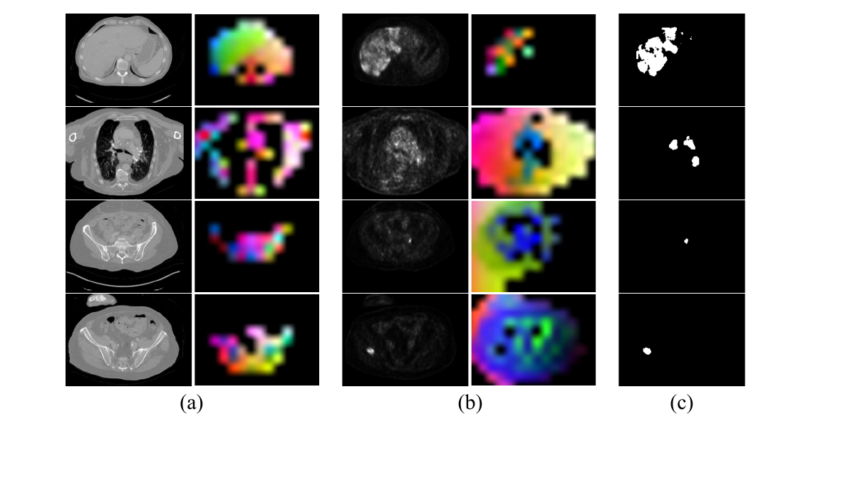 DINOv3 PET/CT feature source figure